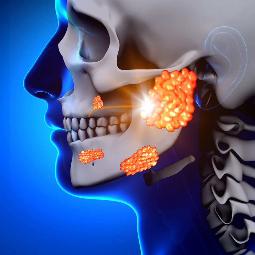 Salivary Gland Disorders ent360