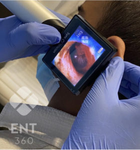 Otoscopy at ENT360 by best ear ENT doctor