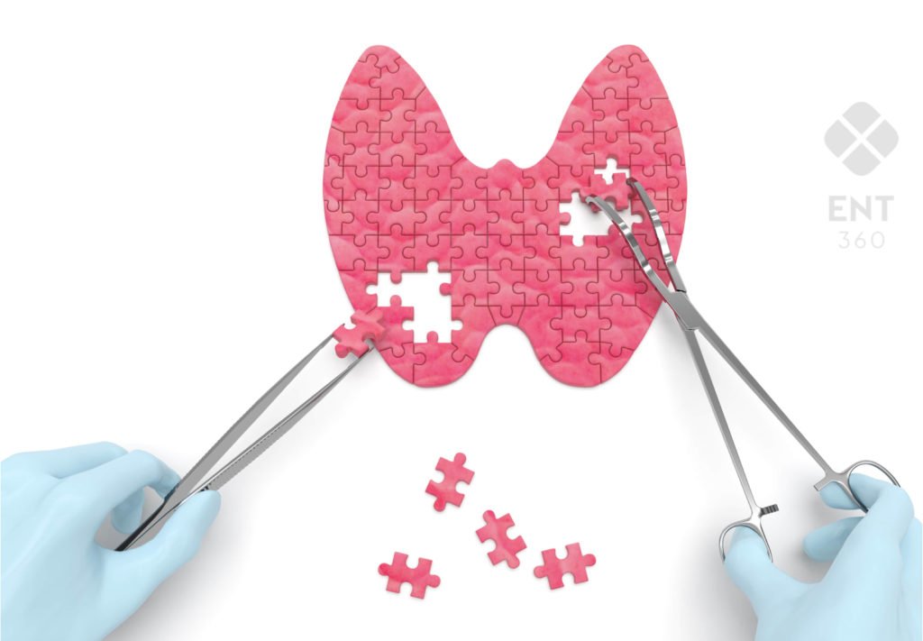 Thyroid and parathyroid surgery