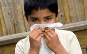 Child with runny nose in covid-19
