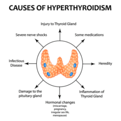 Hyperthyroidism - ENT Specialist in Gurgaon – Dr. Akanksha Saxena